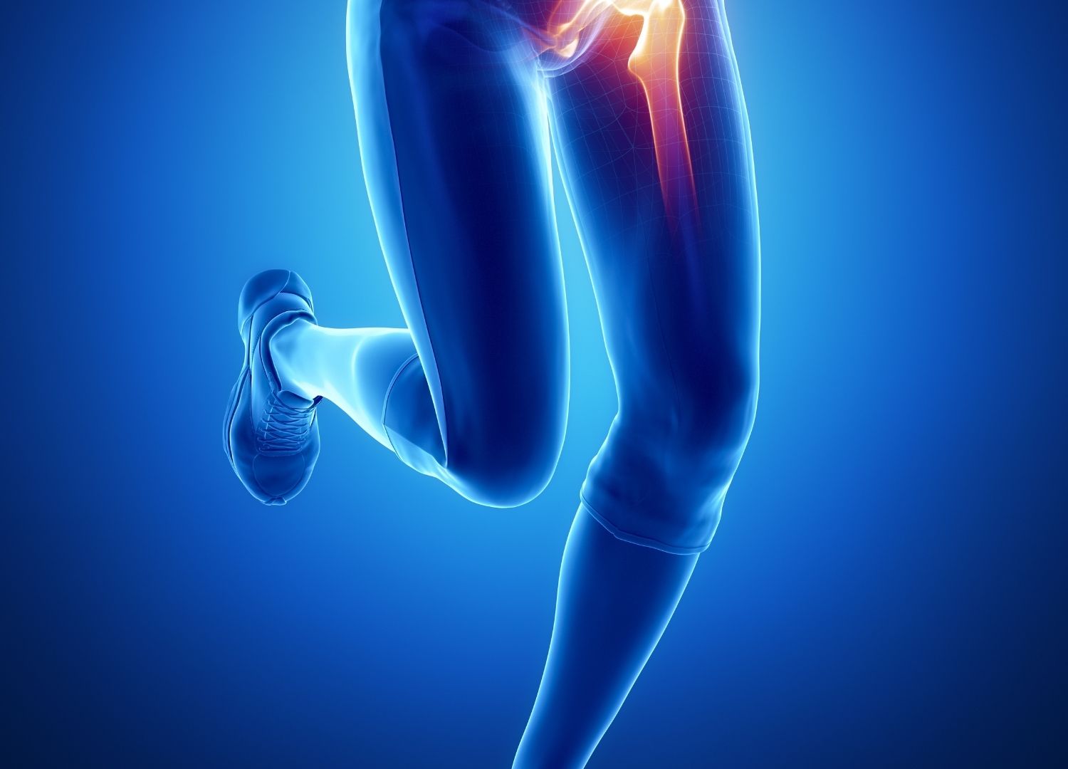 Hip Arthritis