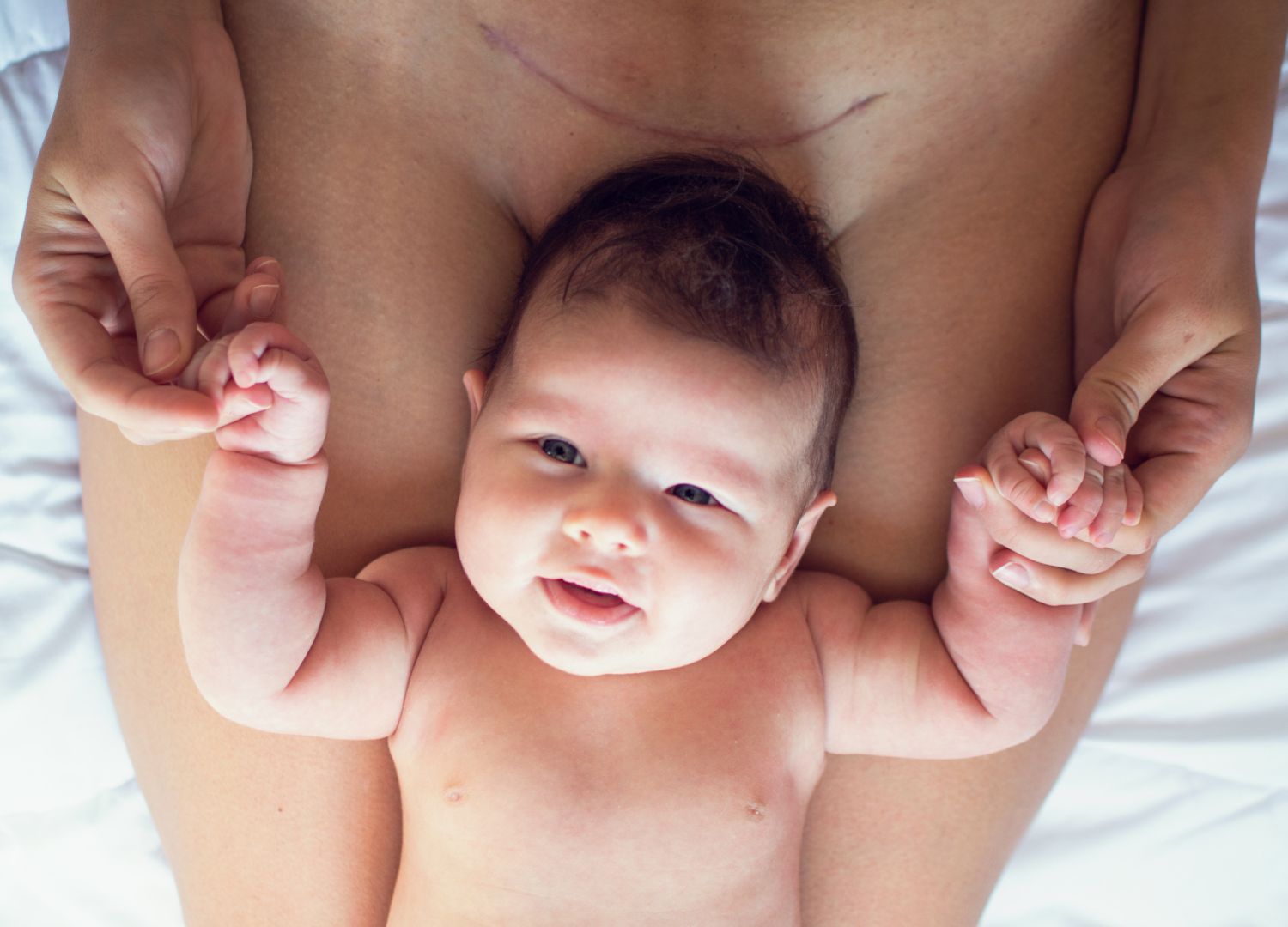 Selfcare after a Caesarean section (Pidgin)