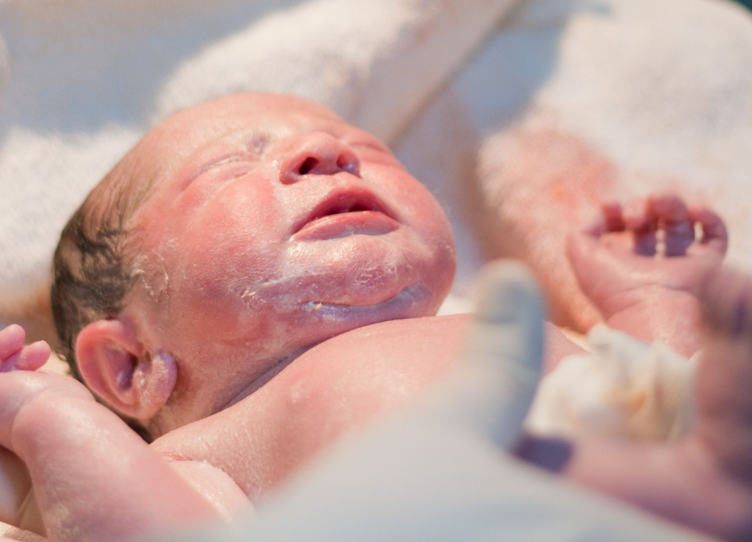 Birth Asphyxia (Pidgin)