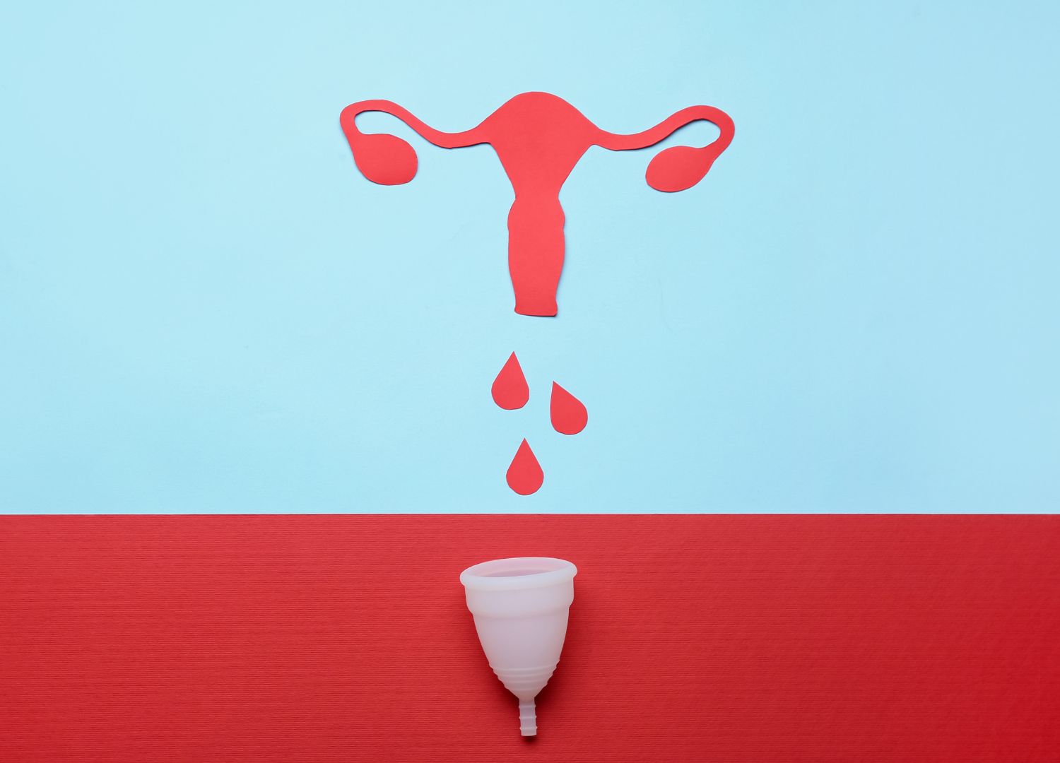 Menorrhagia (Pidgin)