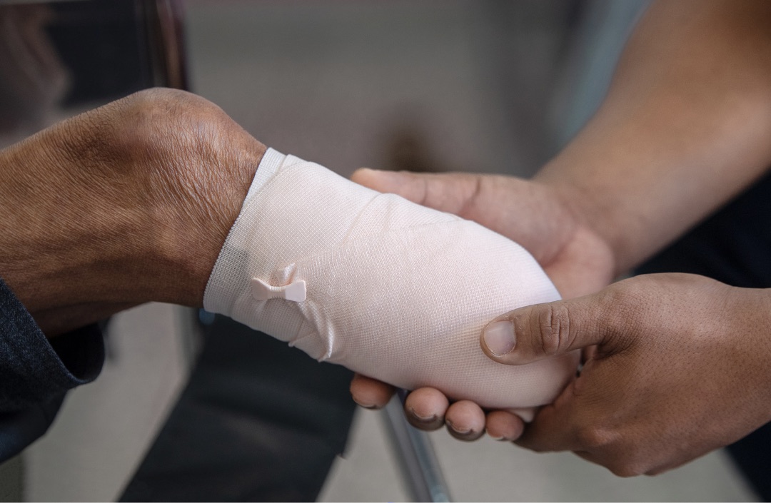 Diabetic foot