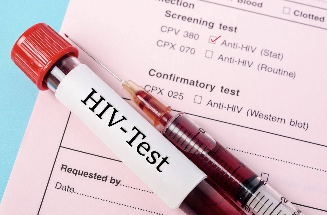 Health complications of HIV