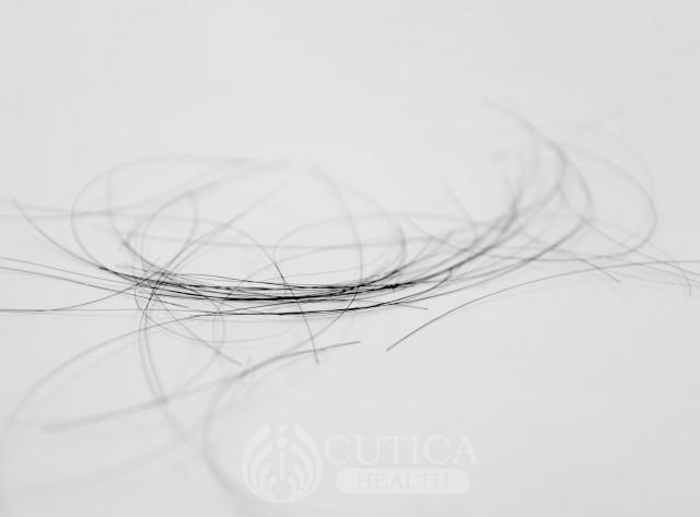 Hair Loss and Baldness in Men