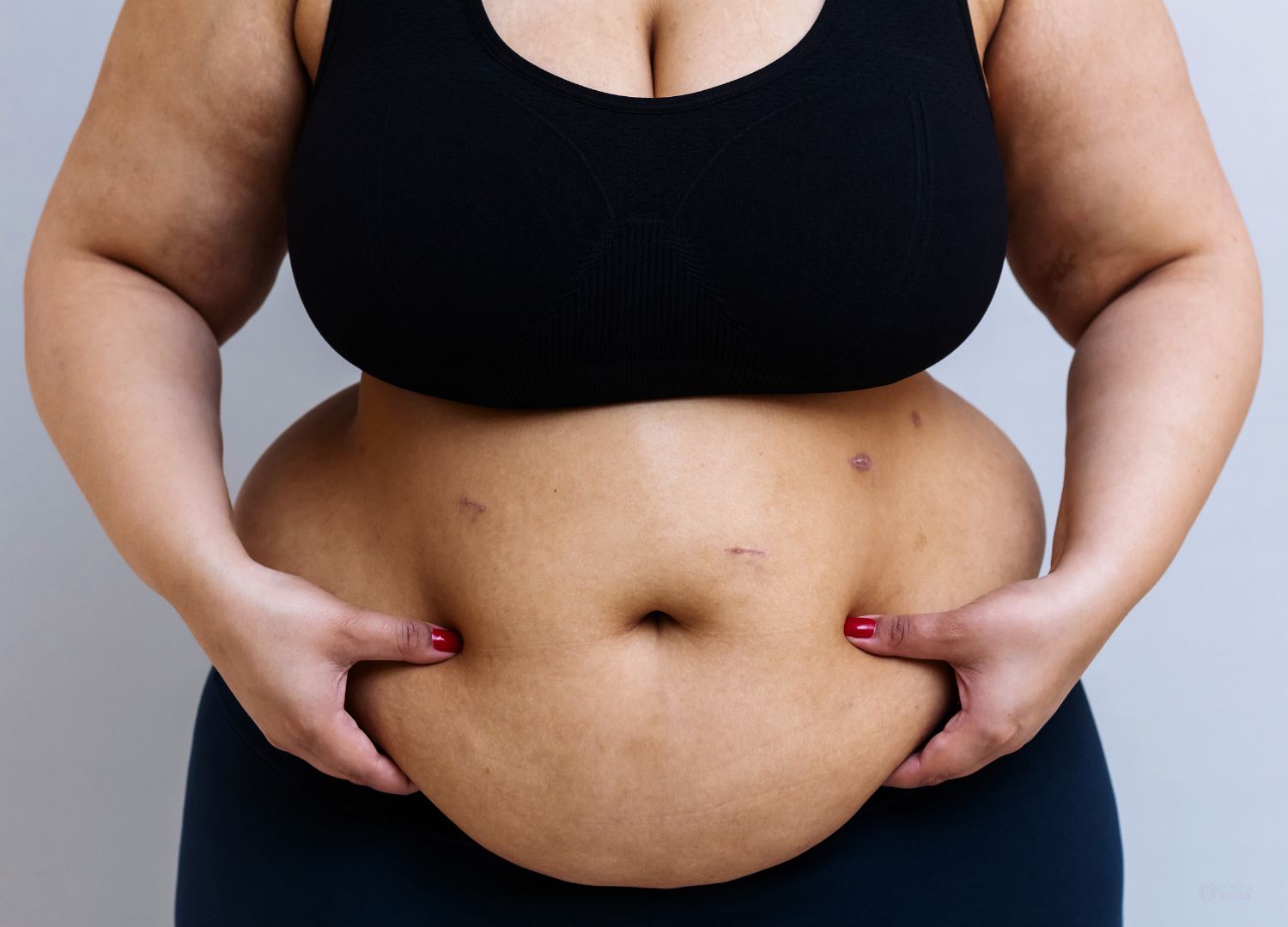 Ten Proven Ways to Reduce Belly Fat: A Complete Guide