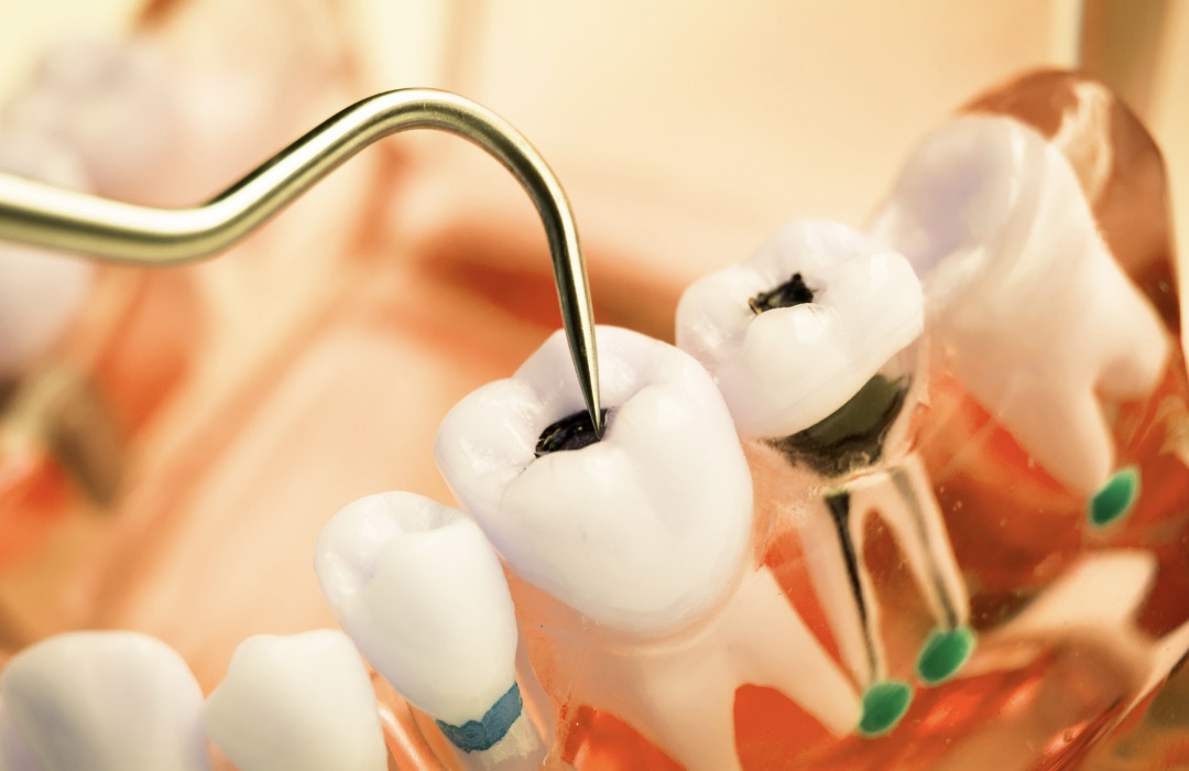 Homecare for a teething child