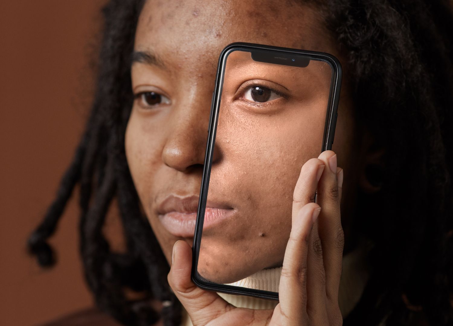 Dangers of skin bleaching (Pidgin)
