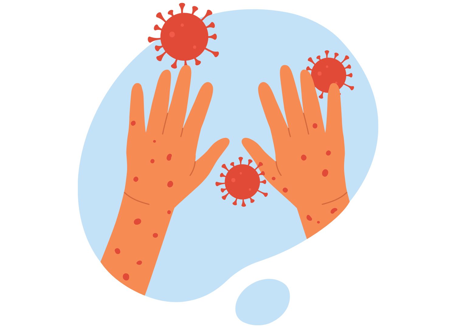What to Know about Monkeypox 24-10-2022 (2)