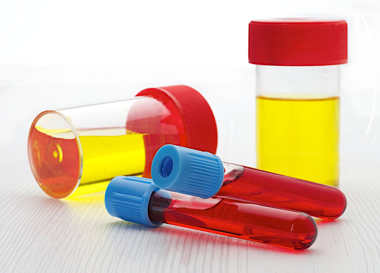 Why do I have Blood in my Urine  21-12-2022 (3)